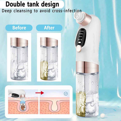 Facial Vacuum Cleaner