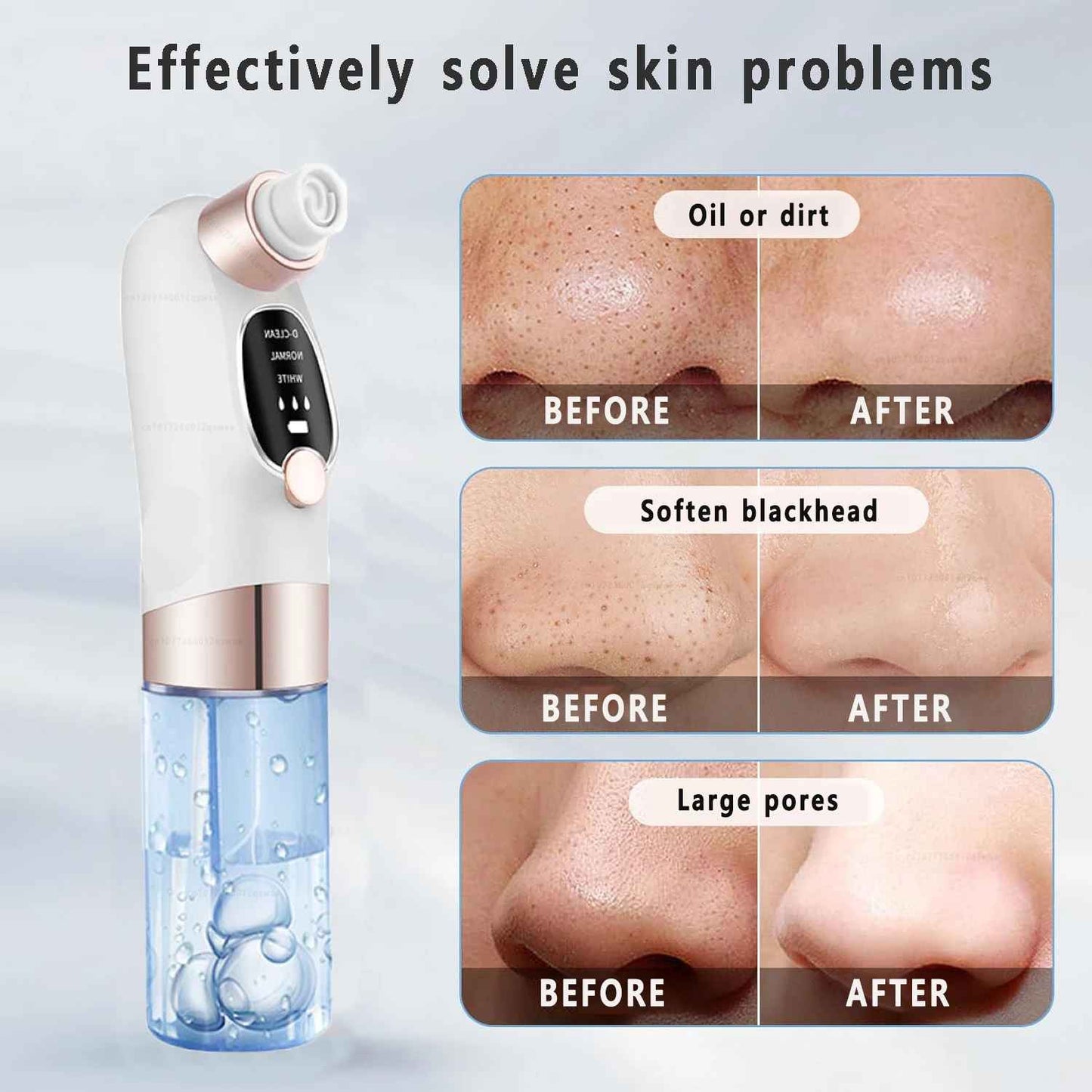 Facial Vacuum Cleaner