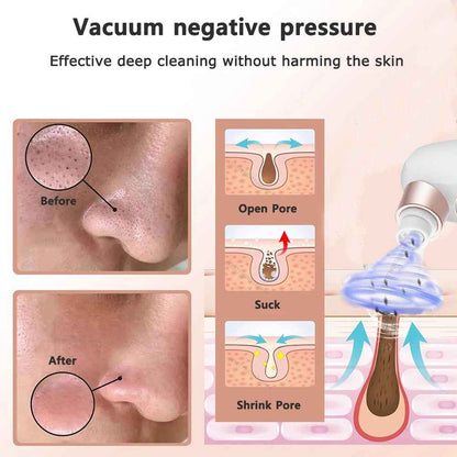 Facial Vacuum Cleaner
